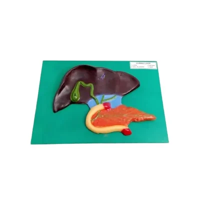 Akivin Liver Anatomy Hepatocytes Portal System Model Pathological Conditions