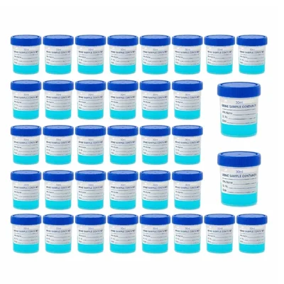 VVS Polypropylene Urine Sample Bottles 30ml With Lid Pack of 40pcs for Medical Lab