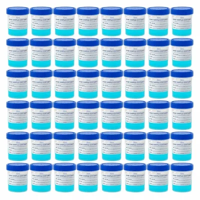VVS 30ml Pack of 50pcs Polypropylene Urine Sample Bottles With Lid Nursing Hospitals Medical College Lab Laboratory