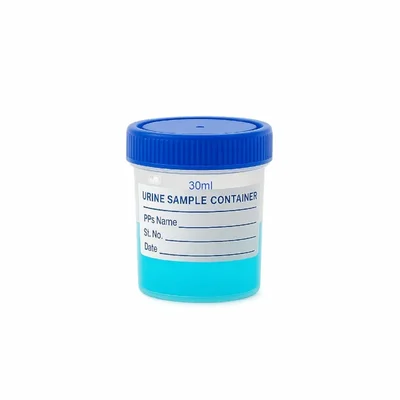 VVS 30ml Pack of 100pcs Polypropylene Urine Sample Bottles With Lid Nursing Hospitals Medical College Lab Laboratory