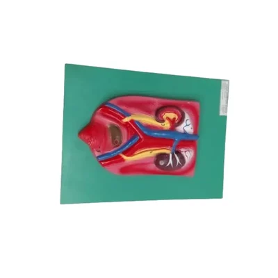 Akivin Excretory Anatomical Model Dissectible Color-Coded Kidneys Urinary System Nephrons Bladder Ureters
