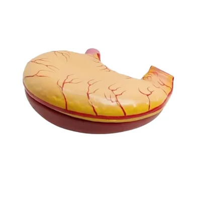 Akivin Stomach Gastric Enlargement Model Anatomical Non Toxic PVC Digestive Healthcare Learning