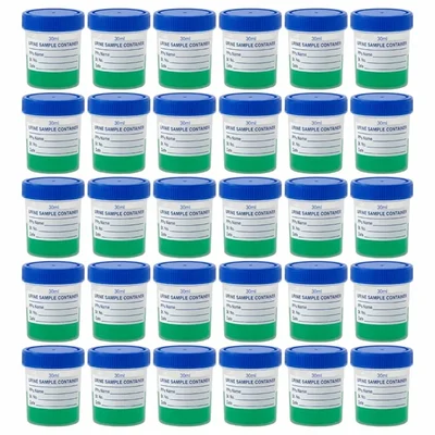 LABXPRT 30ml Polypropylene Urine Sample Bottles Pack of 30pcs for School College Chemistry Lab Laboratory With Lid